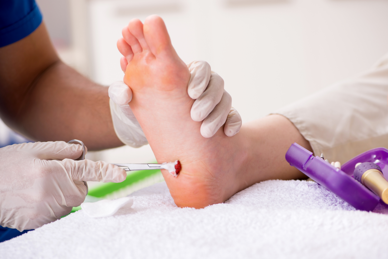 How To Care For A Puncture Wound — WoundCare University